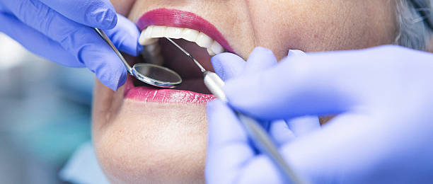 Best Emergency Wisdom Teeth Removal in Cheval, FL
